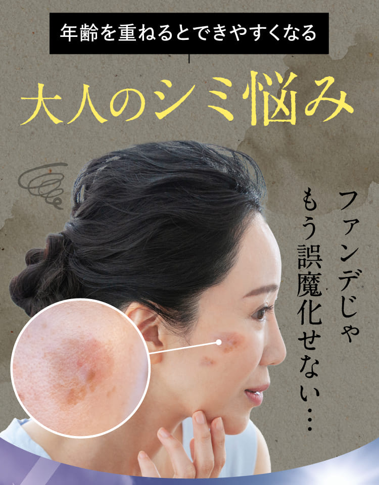 年齢を重ねるとできやすくなる大人のシミ悩み