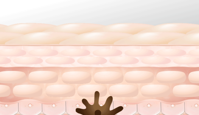 シミ予備軍が肌の奥に潜んでいる様子